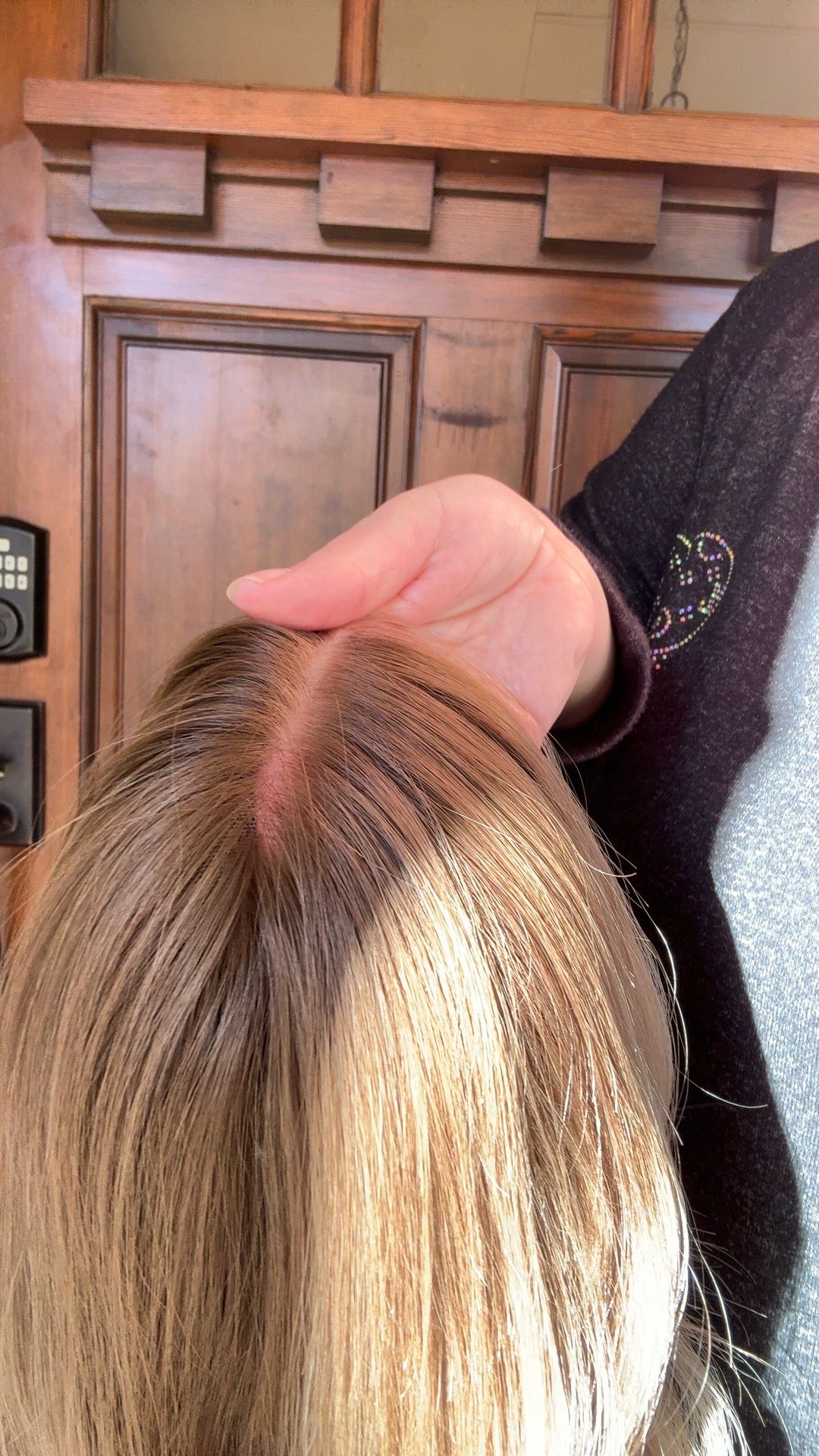 Amelia Lace Top Human Hair Wig | Custom Colored Lob for Hair Loss