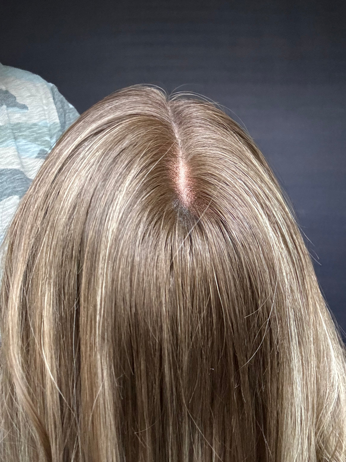 Lilly Medium Lace Top Wig -The Fine Collection