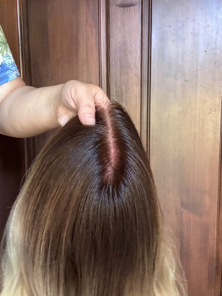 scalp and part of wig